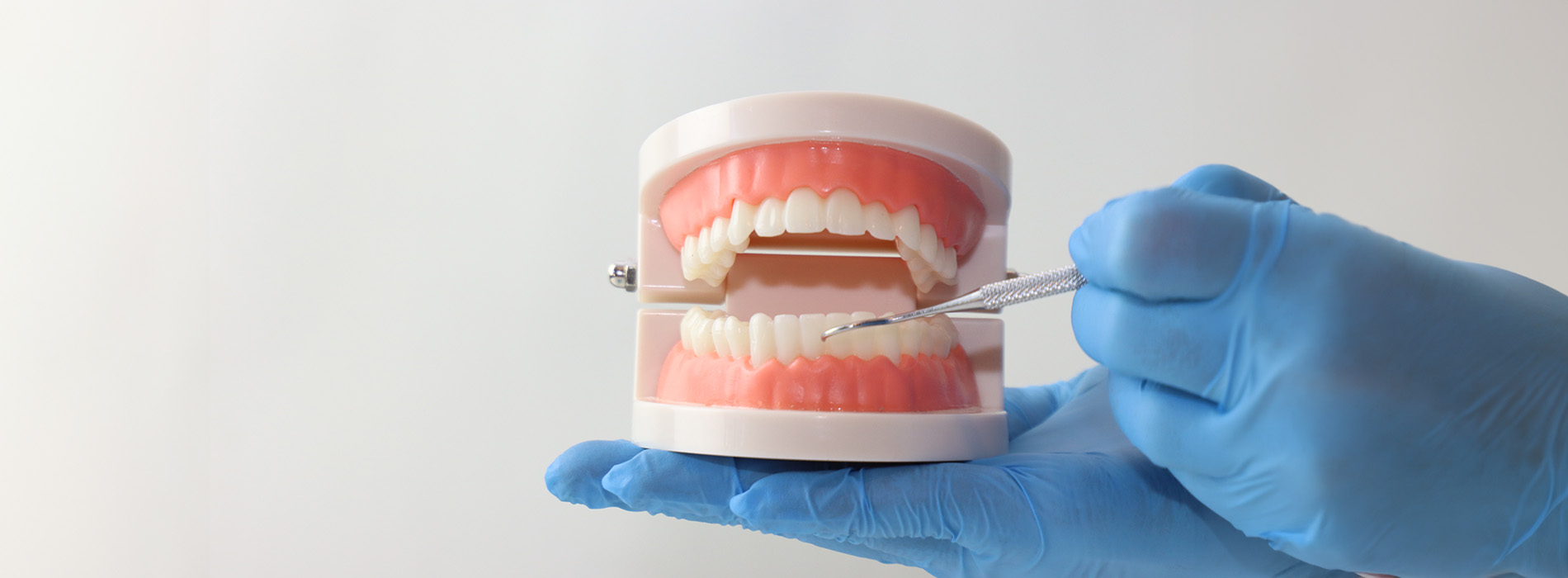 The image shows a dental implant being prepared with a toothbrush in a laboratory setting, under the supervision of a person wearing gloves and protective eyewear.