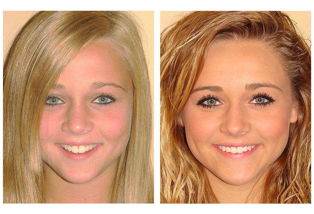 A Center for Dental Excellence