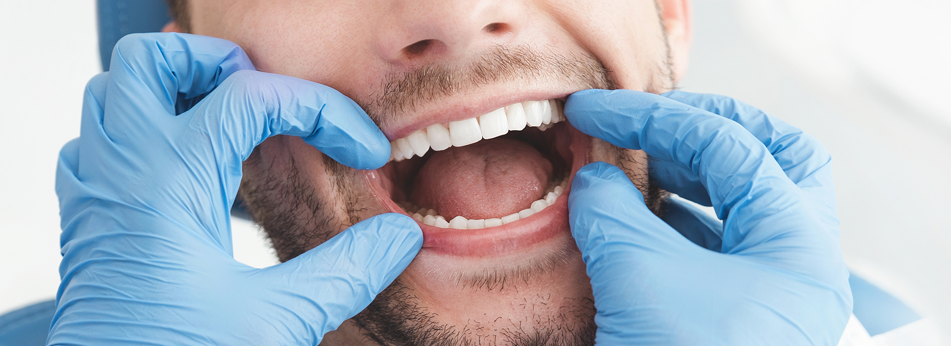 A man wearing medical gloves holds his mouth open with both hands, showcasing a bright smile.