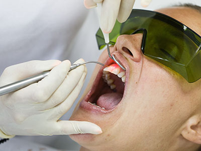 A woman receiving dental treatment with a dental dam and an instrument in her mouth.